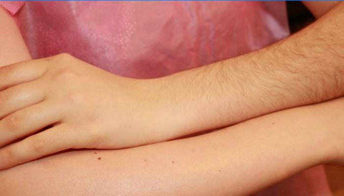 Händer på en flicka före och efter vaxning